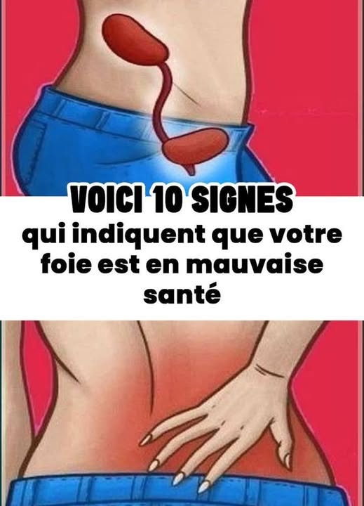 10 signes qui indiquent que votre foie est en mauvaise santé