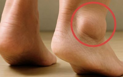 Pieds qui gonflent : quelles significations et quelles solutions ?