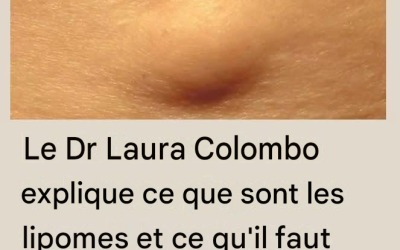 Le Dr Laura Colombo explique ce que sont les lipomes et ce qu'il faut faire si vous en avez un (1 / 2)